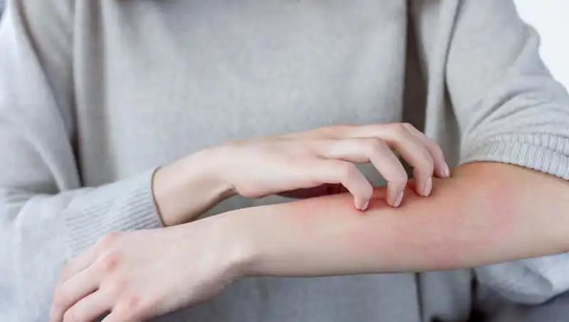 Cilt Kanseri Belirtilerini Gözden Kaçırmayın: Dermatologdan Uyarılar