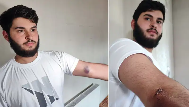 Bahçeye Kaçan Top, Mahallede Büyük Bir Karmaşaya Neden Oldu